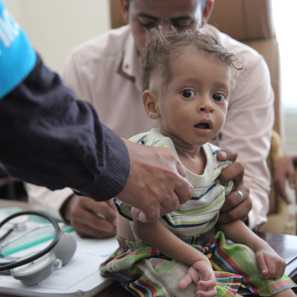 A boy is screened for malnutrition in Sa’ada, Yemen, Thursday 20 October 2016. Nearly 182,000 children in Yemen were treated for severe acute malnutrition as of October 2016. Unicef/2016/Al-Zikri